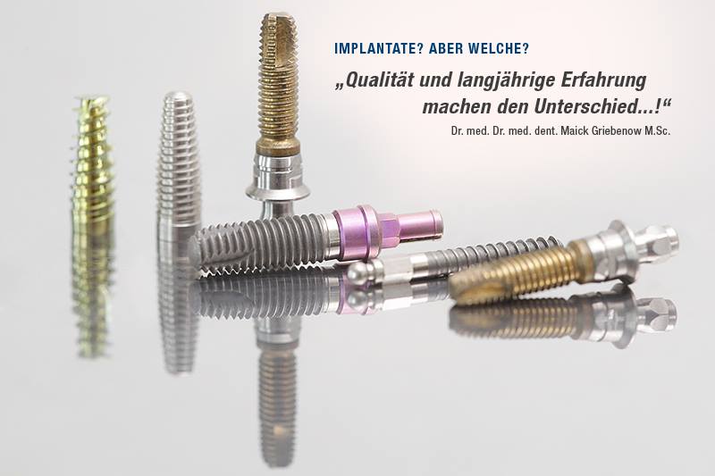 welche implantate sind die besten