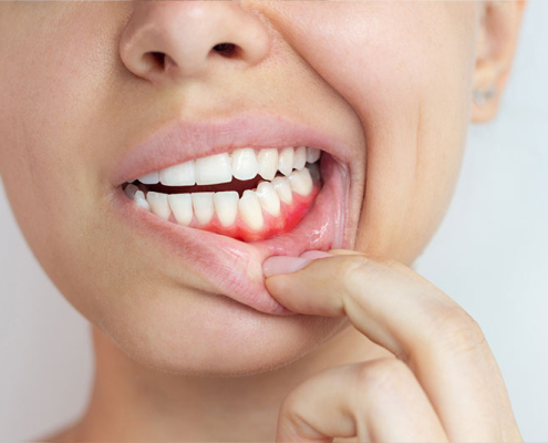 eine Nahaufnahme des Mundes einer Frau