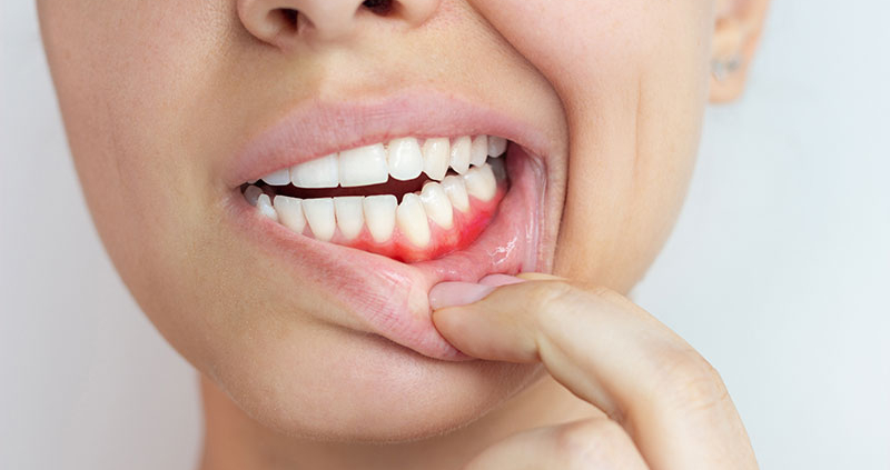 eine Nahaufnahme des Mundes einer Frau