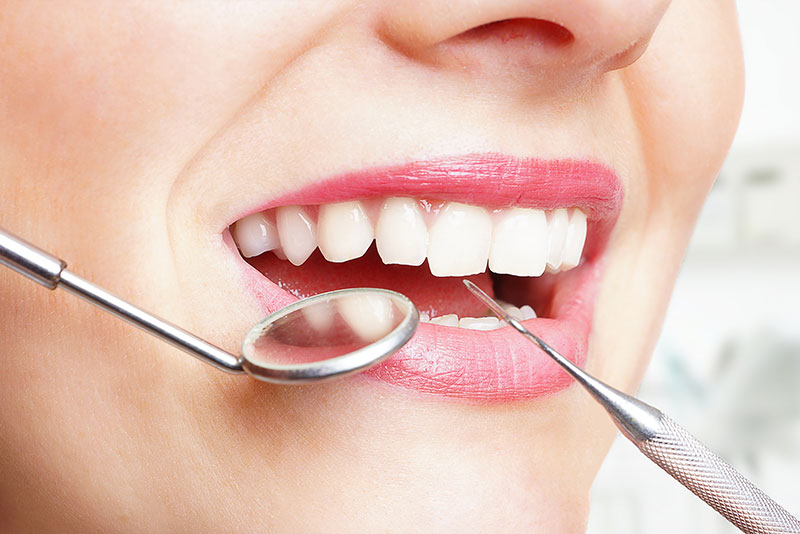 Nahaufnahme des Mundes einer Frau mit Zahnarztwerkzeug