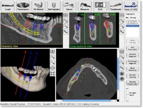 robodent-behandlung-dortmund Robodent Behandlung