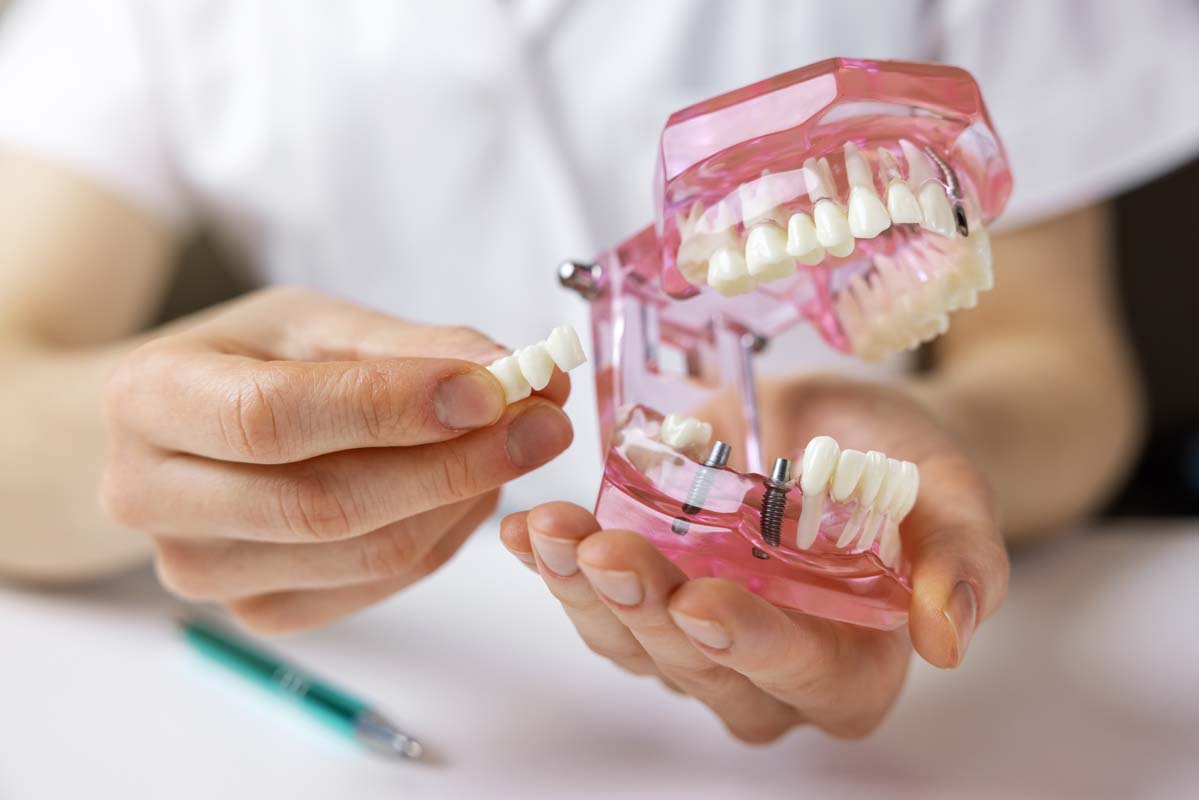 Keramikimplantate