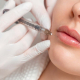 Lippenkorrekturen