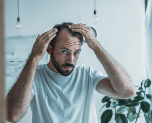 Mann sieht sich seine Geheimratsecken